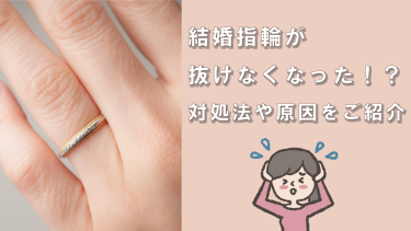 結婚指輪が抜けなくなった！対処法は？消防署へ行った方がいいの？